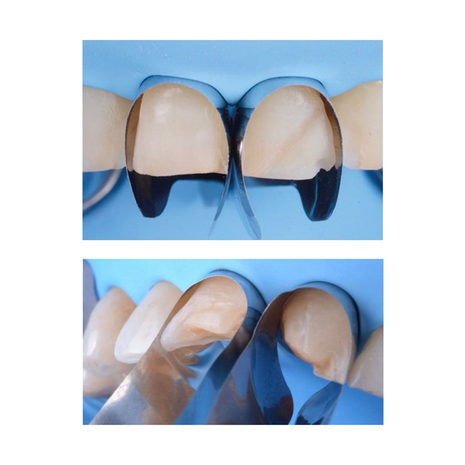 Tecci Twin Spoon Matrix